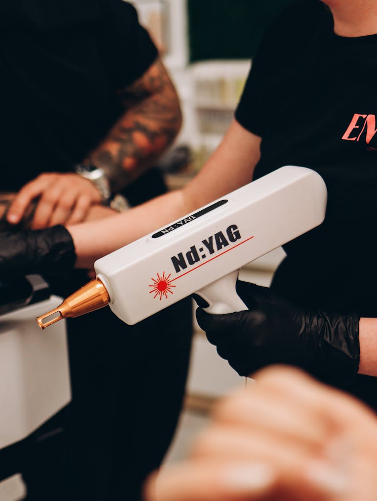 Enntal Close-up of Nd:YAG laser used in tattoo removal procedure at a clinic in Poland.